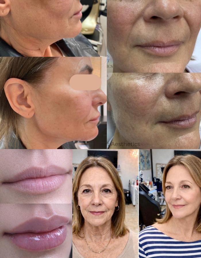 Perfect Aesthetics & Spa