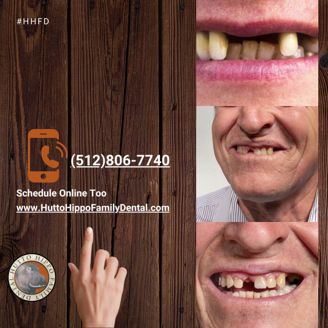 Hutto Hippo Family Dental